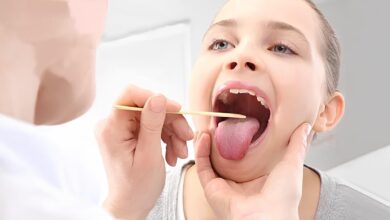 Boğaz Ağrısına Ne İyi Gelir Boğaz Ağrısı Nasıl Geçer